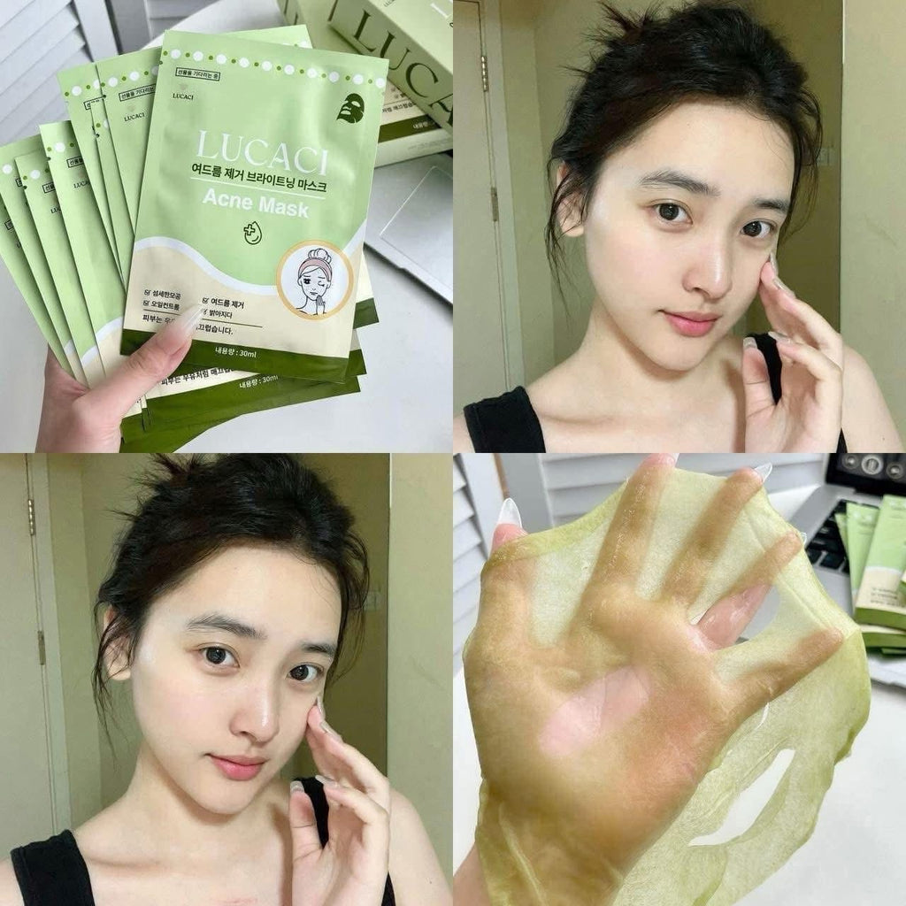 Lucaci Acne Mask Mask (10pcs/box)